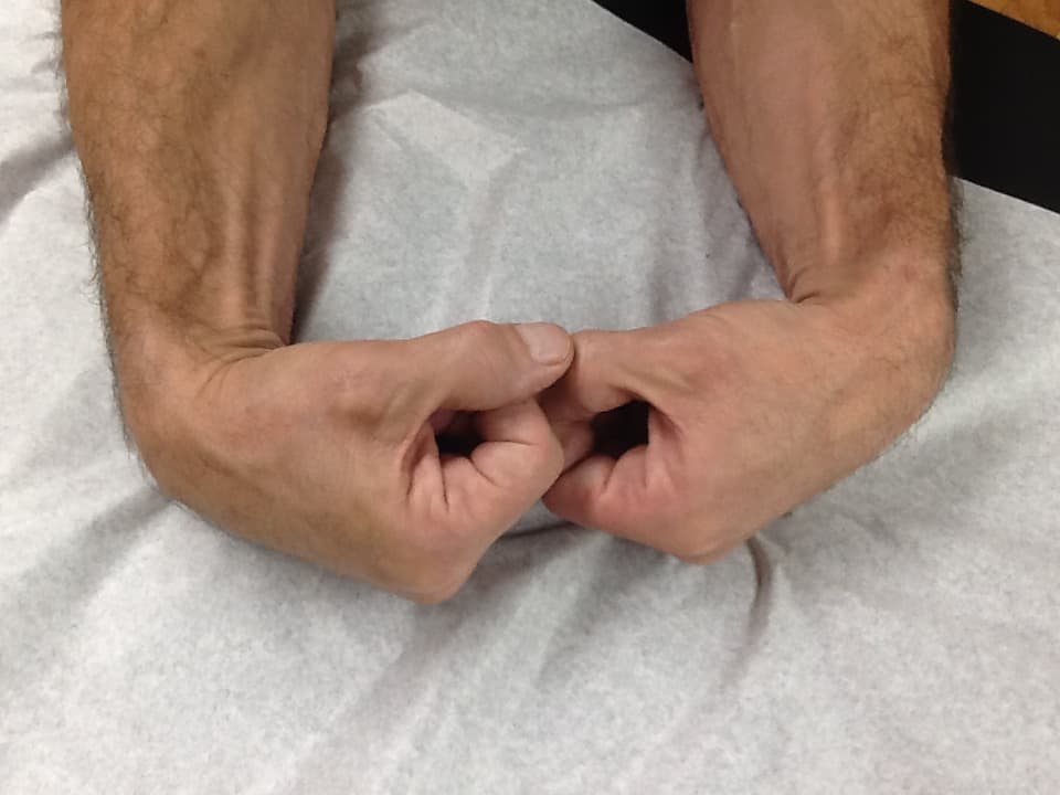 Hand Numbness While Sleeping - Dr. Lox Discusses This Common Problem