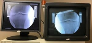 knee x-ray