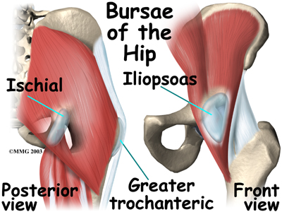 Looking back on my pregnancy; may I present Hip Bursitis