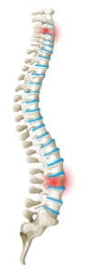 Back Pain Stem Cell Therapy Dr. Lox