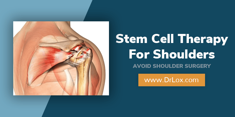 Stem Cell Therapy For Shoulders In Clearwater, Tampa Bay, Fl - Dr. Lox