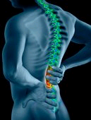 lower back pain